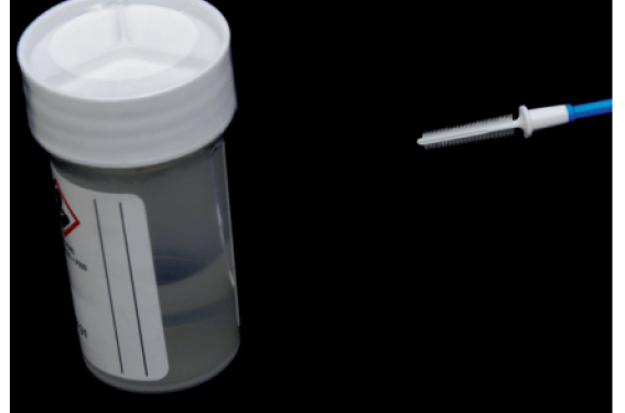 Tests HPV : quels outils en pratique ?